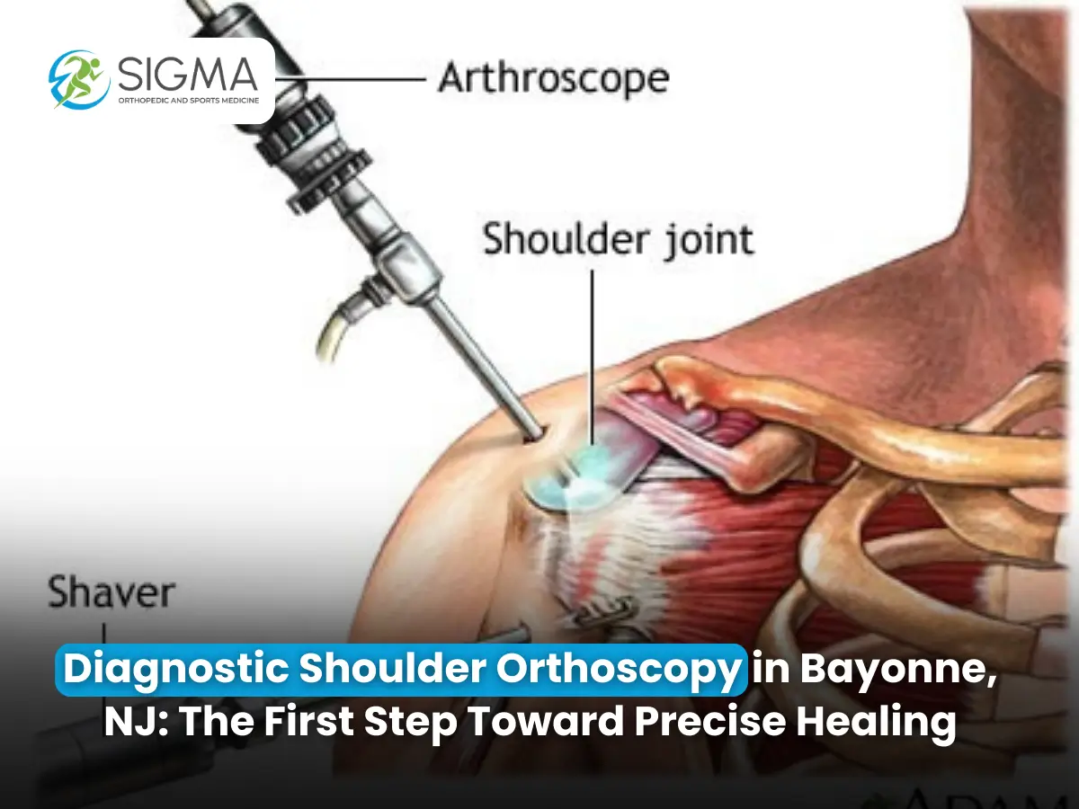 Diagnostic Shoulder Orthoscopy in Bayonne
